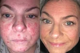 Heatwave friendly SPF that's dermatologist-approved and gives shoppers 'more confidence'