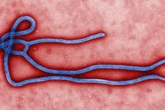 Ebola outbreak sees 15 die from disease that 'makes eyes bleed'