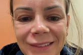 Woman's warning after severe reaction to popping pimple in 'triangle of death'