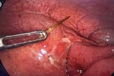 Doctors make horror find in stomach of man in 'severe pain' after eating dinner