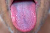 Simple tongue test could reveal early signs of serious health conditions