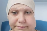 Midlands mum who had scalp ripped off in horror work accident wins seven-figure payout