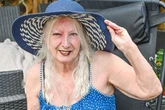 Gran left 'disfigured and unrecognisable' after falling asleep in garden