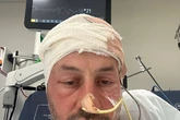 'I was diagnosed with two brain tumours after mistaking symptoms for something else'