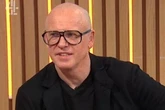Sunday Brunch's Tim Lovejoy reveals he walked out of hair transplant