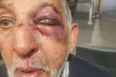 Face of battered Kings Heath taxi driver as man arrested over attack