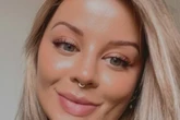 Woman issues warning after 'mouth ulcer' turns out to be cancer