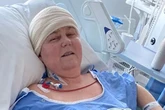 Chelmsley Wood grandma diagnosed with brain tumour after routine eye test reveals critical signs