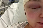 Teacher told headaches due to contraceptive pill diagnosed with brain tumour