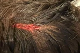 Woman's head split open after 'hit-and-roll' skater careers into her in Sutton Coldfield