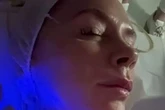 Victoria Beckham shares results of 'mini lift' face treatment she swears by