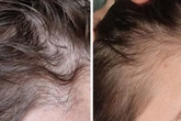 Woman's hair transformation with 49p supplements after 'disaster' left her tresses damaged