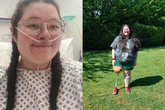 NHS nurse, 26, has leg amputated after noticing 'aching' leg pain