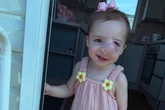 Little girl dies of cancer after doctors 'assume lump on face was caused by parents'