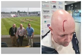 Cricket fan suffers head injury by flying cup at Edgbaston's T20 match stormed by drunk students
