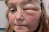 Gran suffers horror burns as neighbour throws boiling water on her while she's with grandson