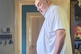 Dad, 65, whose hernia ballooned to size of football wins payout after suing NHS