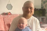 Dad 'beaten to a pulp' in front of children set to have part of skull removed