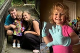 'Amazing' girl, 3, loses fingers and toes to life-threatening condition