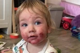 Mum unable to hold baby due to condition which leaves him 'screaming' in pain