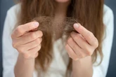 Acne, balding and loss of libido red flags of condition 16% of women have