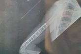 Hospital security guard 'snaps' man's arm during 'illegal' move in dying relative row