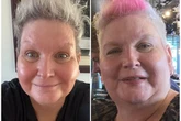 Mum, 54, who lost 4st on Mounjaro claims drug 'cured' Menopause symptoms