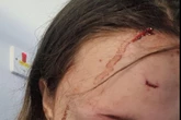 Teen victim of triple HMO stabbing says 'it was like a horror movie'