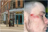Assault probe after claims Turtle Bay reveller 'picked up and thrown out into street' in £17 cocktail row