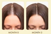 Amazon reduces £18 'amazing' growth serum that 'makes hair feel thicker and stronger'