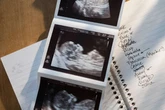 'Entitled' woman wants to approve name for her grandchild and gives parents list