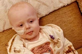 Boy, 2, who is 'always smiling' faces 'aggressive' cancer battle