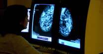 Cancers going undetected as millions of women miss 'vital' breast screening checksBreast cancer