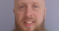 Man 'in agony for years' after dentists fail to treat decaying teethTeeth