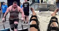 Horror moment Brit strongman's kneecaps 'shoot up' his legs as tendons snap mid-raceAccidents