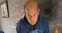 Dad left permanently hunched over in agony due to crippling conditionHospitals
