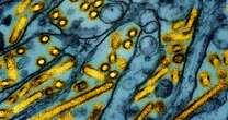 Man, 66, dies from bird flu marking first fatal case in US - Louisiana health officials confirm