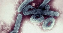 O que é o vírus de Marburg, doença 'prima' do Ebola que fez vítima na Guiné e preocupa a OMS