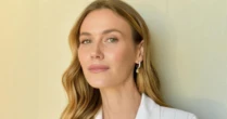 Renata Kuerten relembra infância antes de estrear como modelo: 'Desfilava no caminho de cimento'