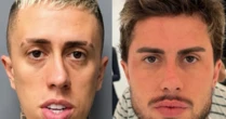 MC Daniel impressiona com antes e depois após procedimentos estéticos: 'outro CPF'