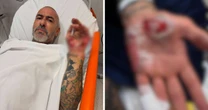 Henrique Fogaça relata que acidente de moto e afirma que teve aliança roubada em hospital