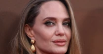 Médico explica diagnóstico que afeta Angelina Jolie e 80 mil brasileiros todo ano: 'Provoca sintomas como boca torta'