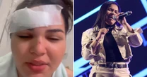 Quem é Greycielle Nunes? Conheça a cantora que foi espancada em bar