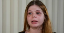Médica agredida pelo namorado fisiculturista está com o rosto paralisado