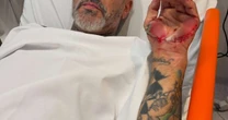 Henrique Fogaça dá detalhes de acidente de moto e revela que aliança foi 'roubada' no hospital; veja