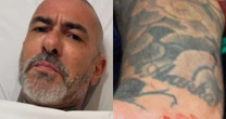Henrique Fogaça ressurge após acidente e apavora fãs com machucados: 'Foi brutal'