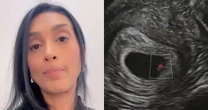 Ex-BBB Amanda Djehdian faz duro desabafo no Dia das Mães após perder o bebê: 'Anjo'