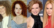 Nicole Kidman já foi assim e você não sabia: 44 fotos do antes e depois da atriz de 58 anos deixa qualquer um de queixo caído