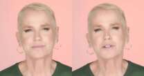 Xuxa revela que fez implante capilar e detalha tratamento: 'Me incomodava bastante'