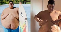 De 350 kg para 220 kg: influenciador Gordão da XJ choca web ao compartilhar antes e depois do corpo após perder 130 kg; veja a transformação em 20 fotos!